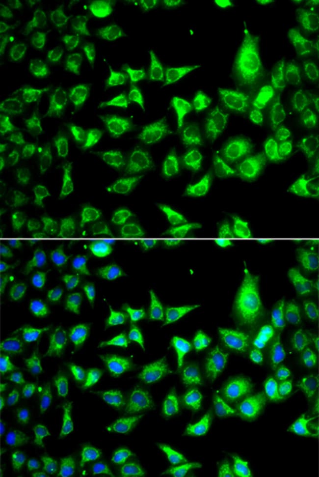100UL ACCS ANTIBODY 100 ul