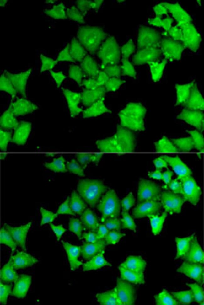 100UL AMINOACYLASE ANTIBODY 100 ul