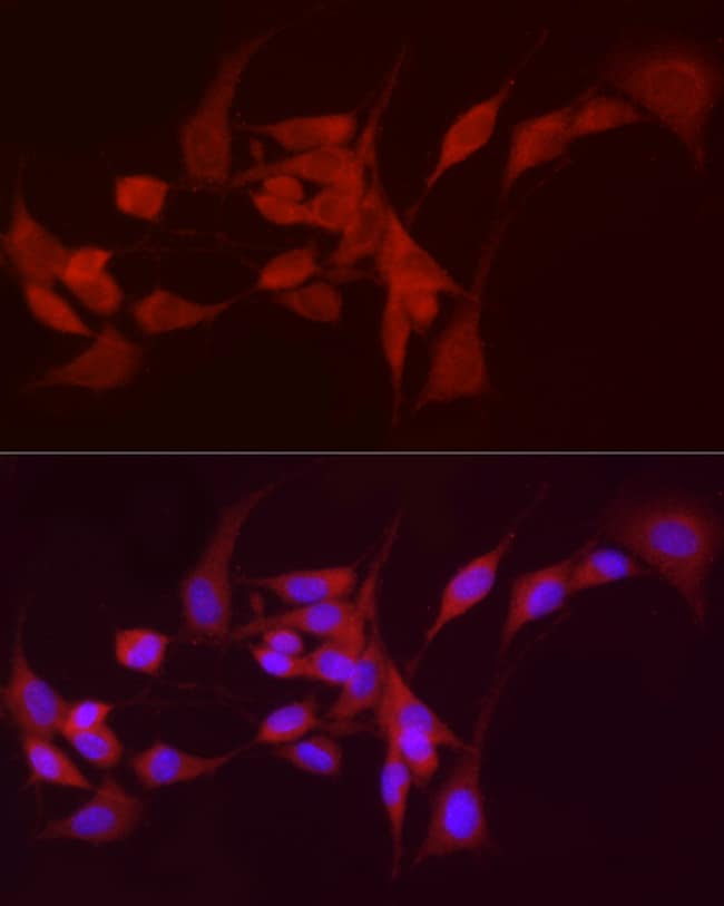 100UL ADH5 ANTIBODY 100 ul