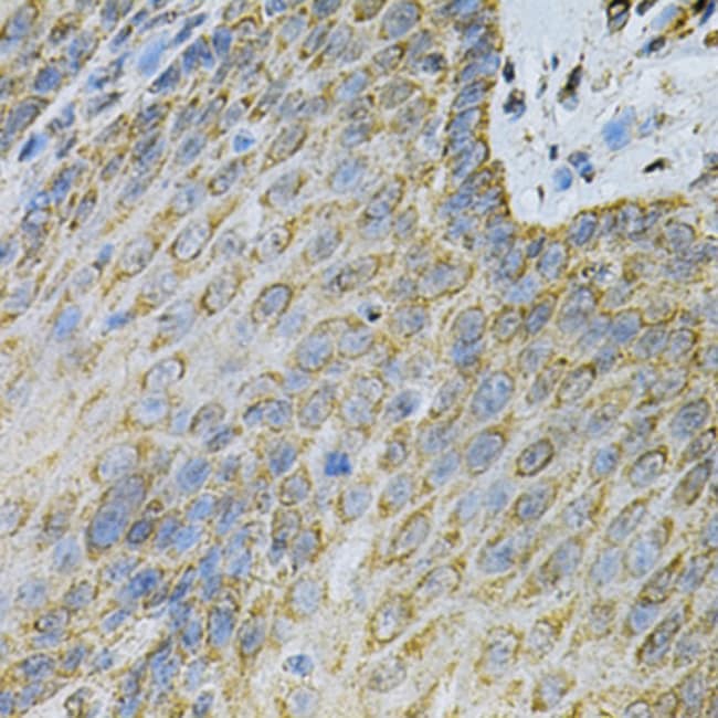 100UL ADENYLATE KINASE 1 ANTIBODY 100 ul