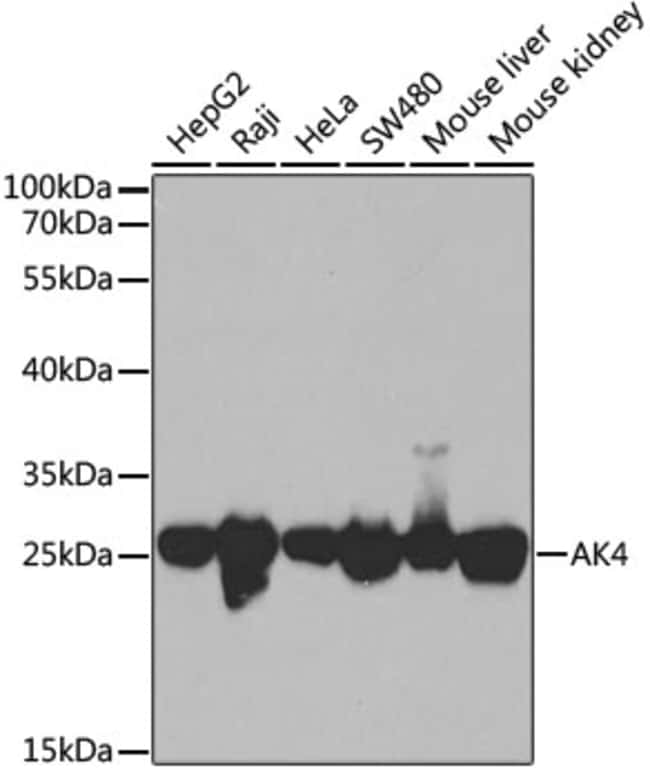 100UL ADENYLATE KINASE 4 ANTIBODY 100 ul