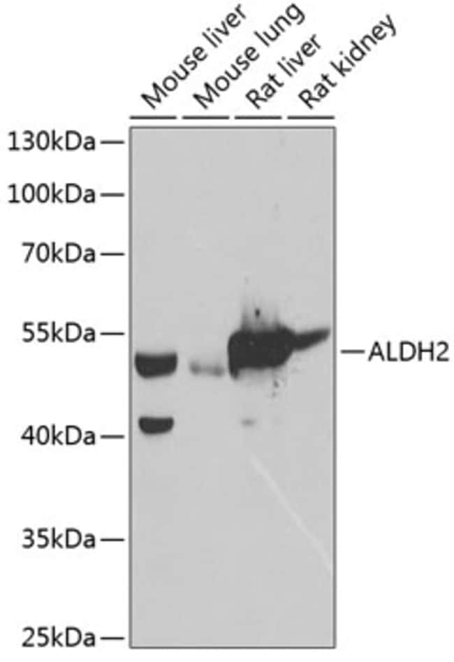 100UL ALDH2 ANTIBODY 100 ul