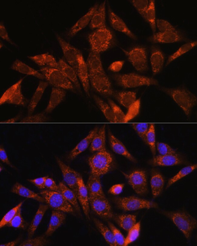 100UL ANGIOGENIN ANTIBODY 100 ul
