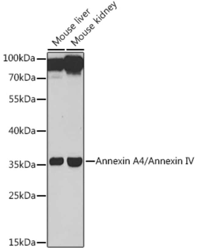 100UL ANNEXIN A4 ANTIBODY 100 ul