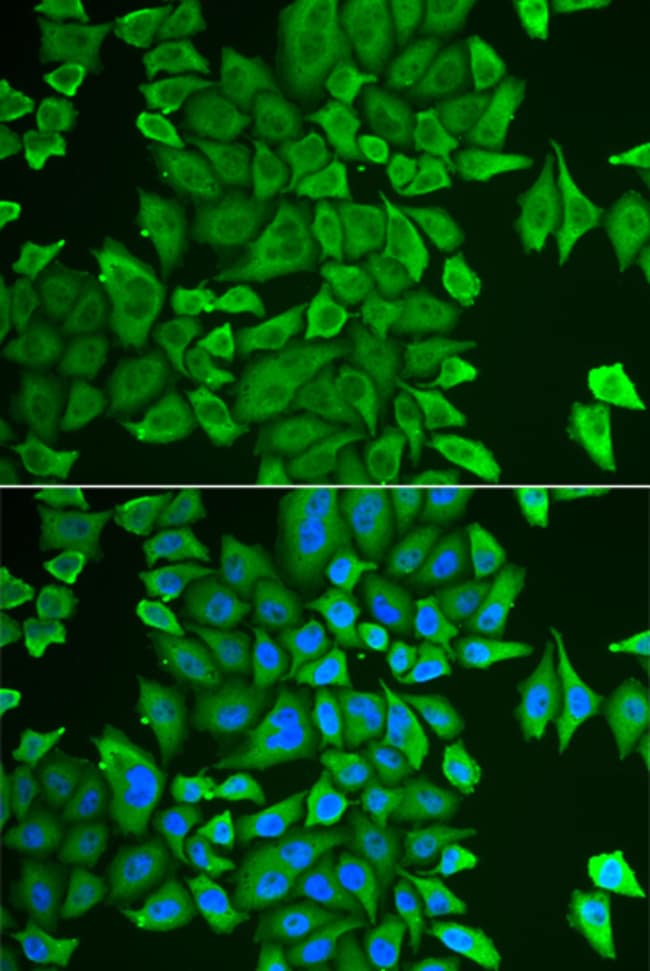 100UL APEH ANTIBODY 100 ul