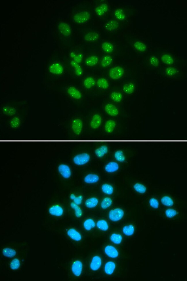 100UL BMI-1 ANTIBODY 100 ul