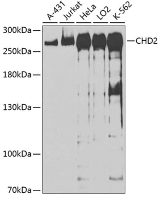 100UL CHD2 ANTIBODY 100 ul