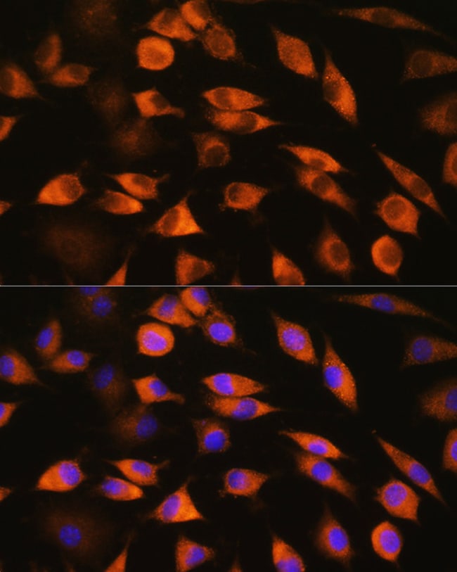 100UL CYP51A1 ANTIBODY 100 ul