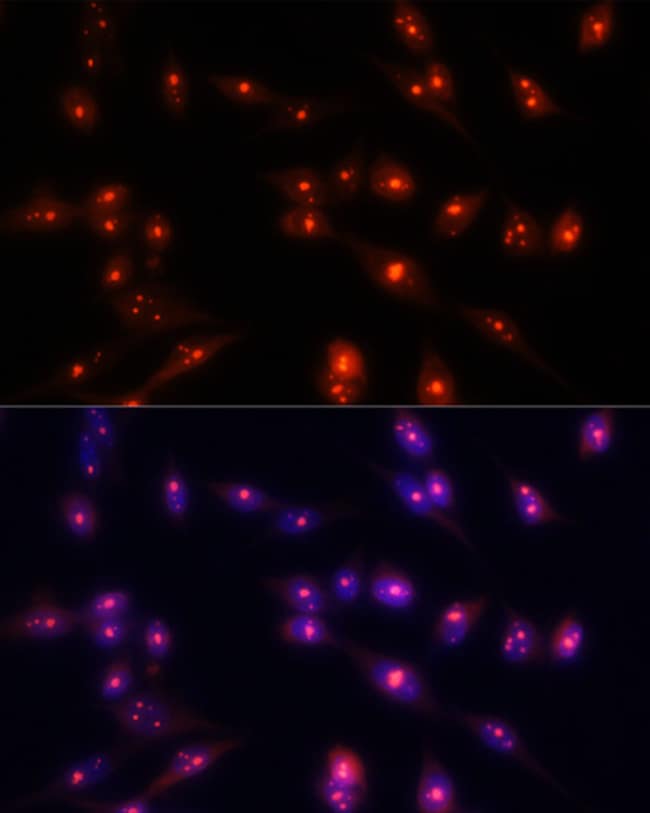 100UL FIBRILLARIN ANTIBODY 100 ul