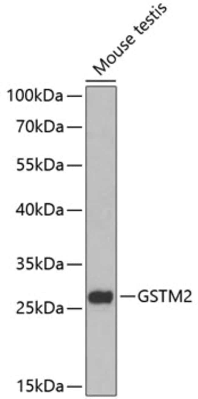 100UL GSTM2 ANTIBODY 100 ul
