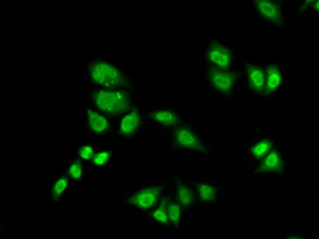 100UL GTF2F2 ANTIBODY 100 ul