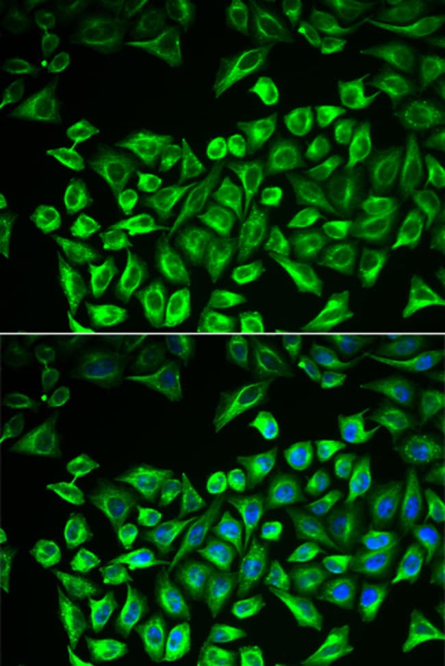 100UL HAS3 ANTIBODY 100 ul