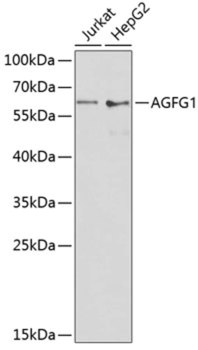 100UL AGFG1 ANTIBODY 100 ul
