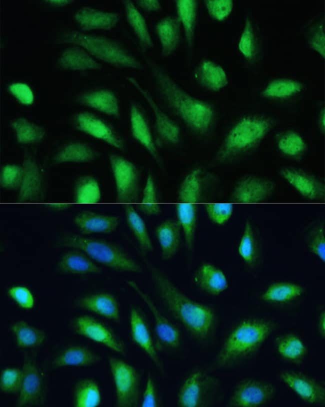 100UL GALECTIN 3 ANTIBODY 100 ul