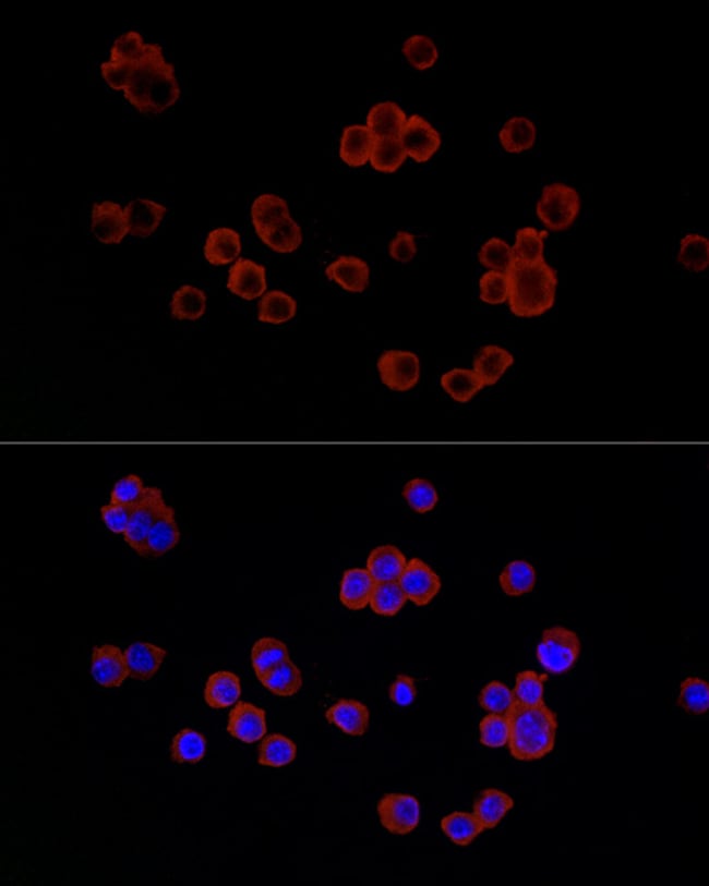 100UL LYSOZYME ANTIBODY 100 ul