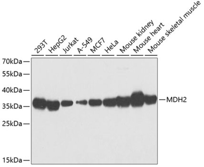 100UL MDH2 ANTIBODY 100 ul