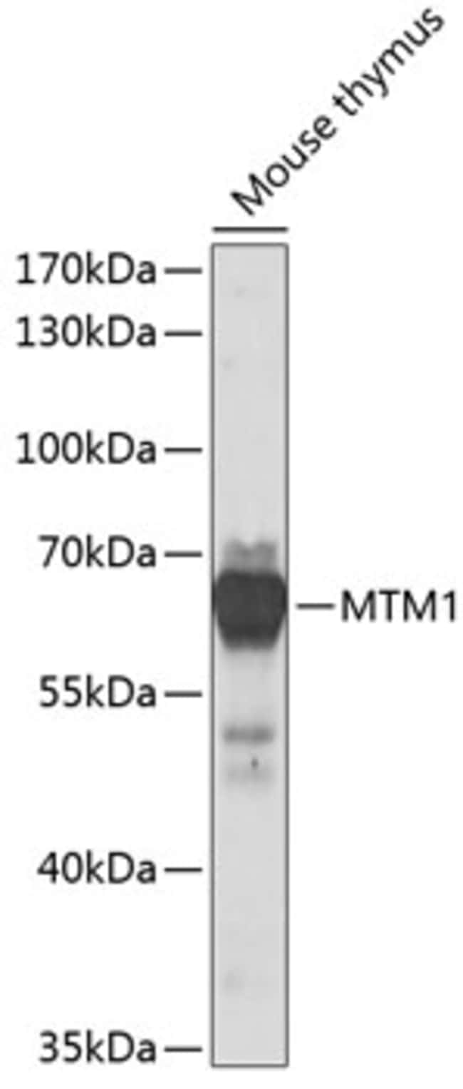 100UL MTM1 ANTIBODY 100 ul