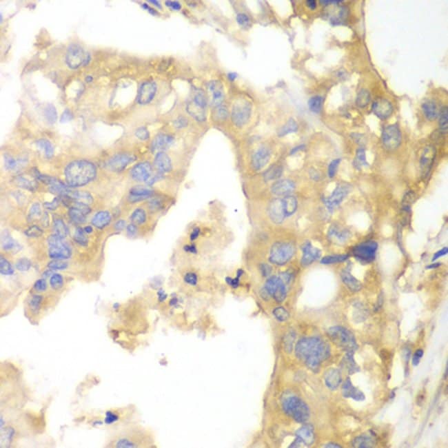 100UL GPBB ANTIBODY 100 ul