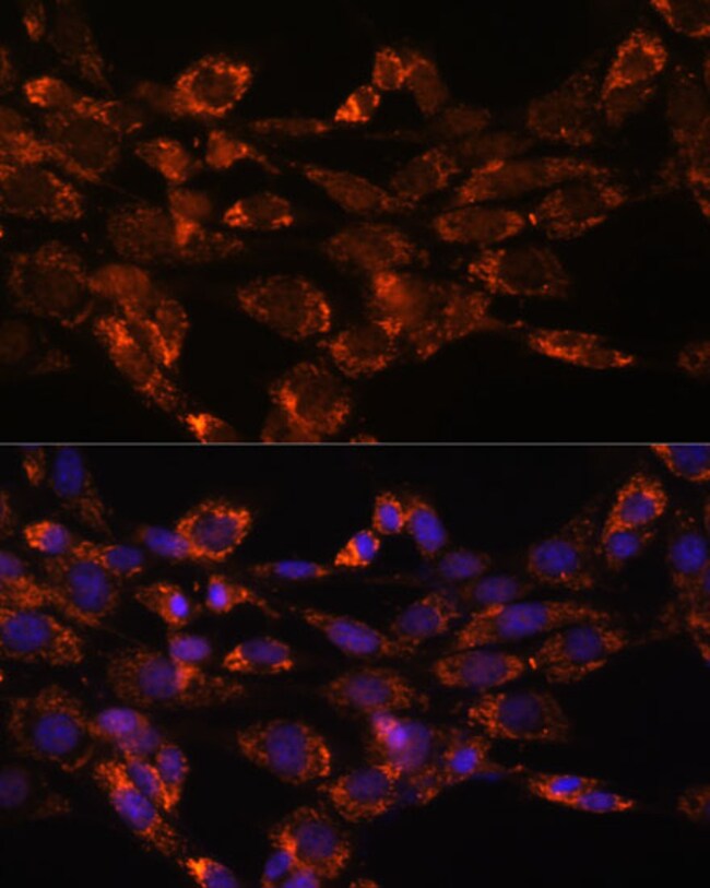100UL MAOA ANTIBODY 100 ul