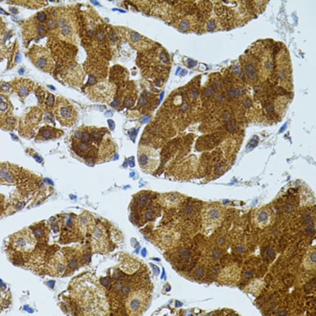 100UL CETP ANTIBODY 100 ul