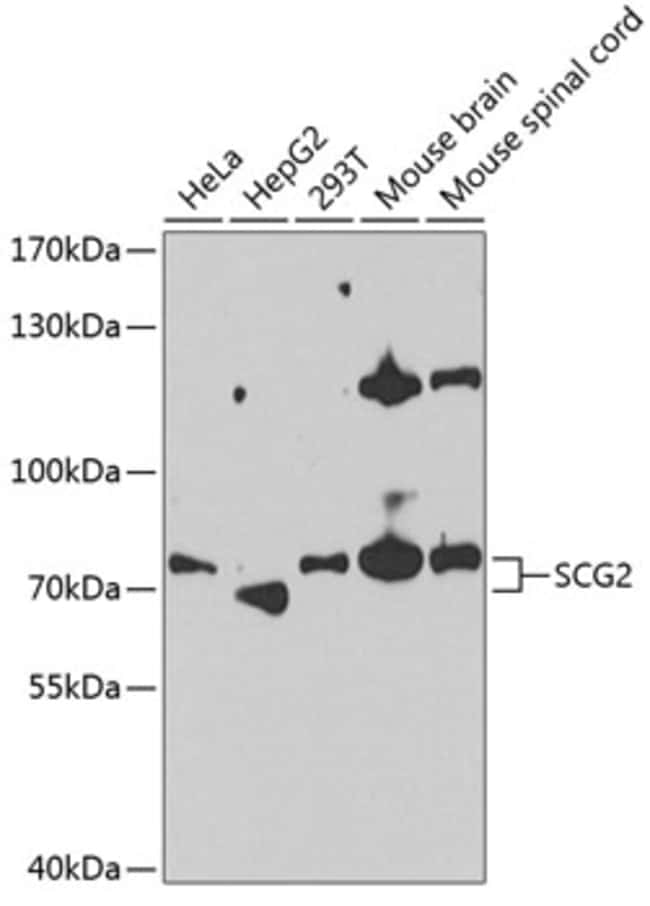 100UL CHROMOGRANIN C ANTIBODY 100 ul