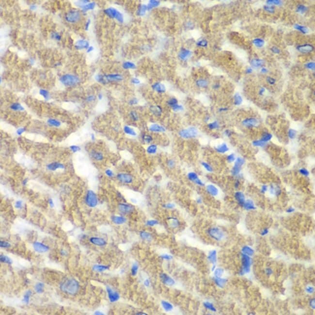 100UL FIBP ANTIBODY 100 ul