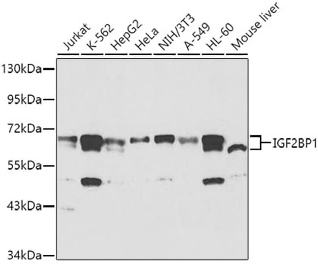 100UL IGF2BP1 ANTIBODY 100 ul