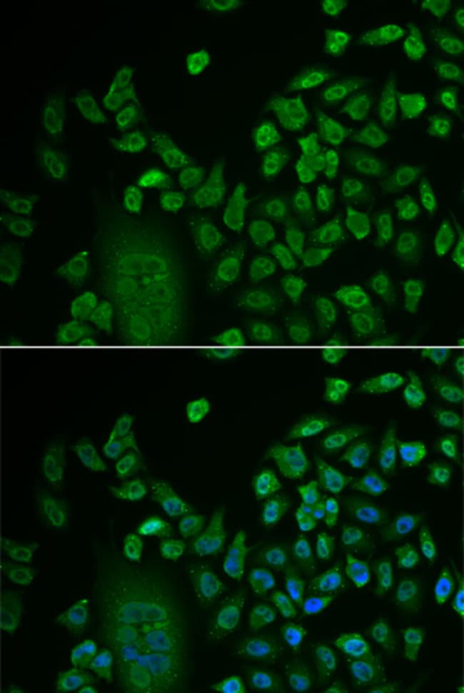 100UL LSM4 ANTIBODY 100 ul