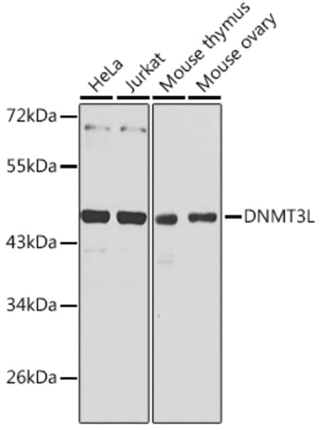 100UL DNMT3L ANTIBODY 100 ul