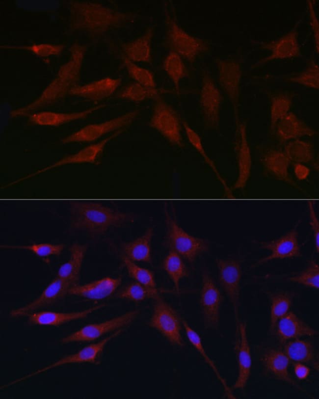 100UL APOBEC3G ANTIBODY 100 ul