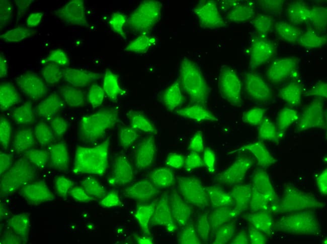 100UL GBL ANTIBODY 100 ul