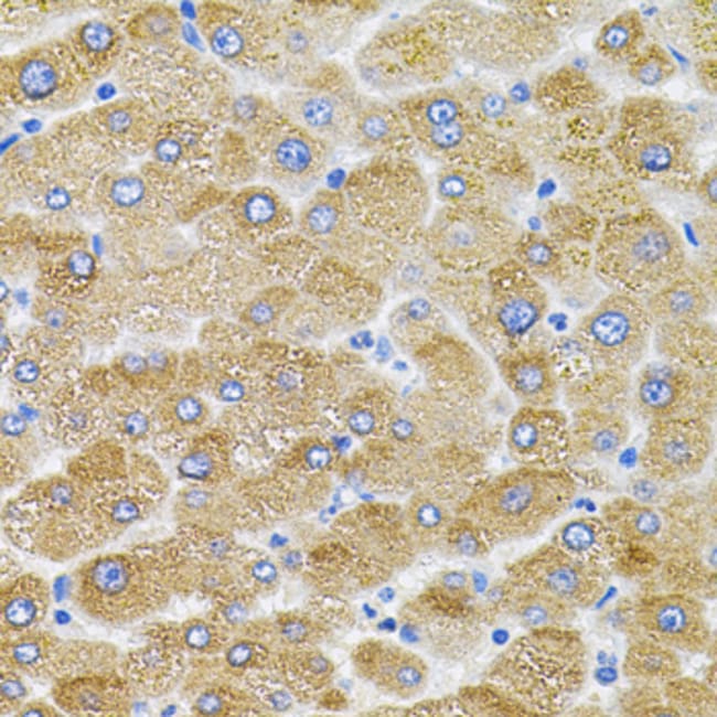 100UL MFN2 ANTIBODY 100 ul