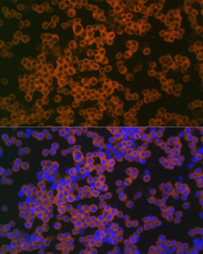 100UL CD38 ANTIBODY 100 ul