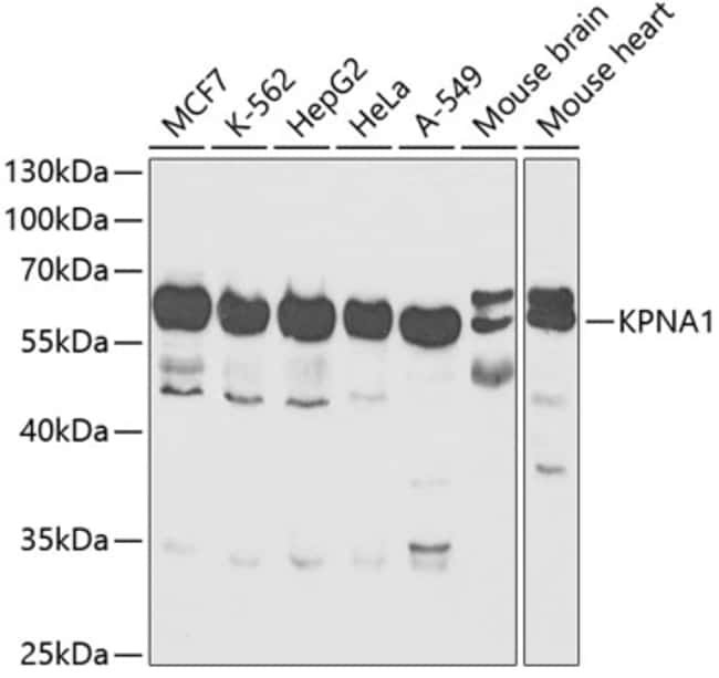100UL KPNA1 ANTIBODY 100 ul