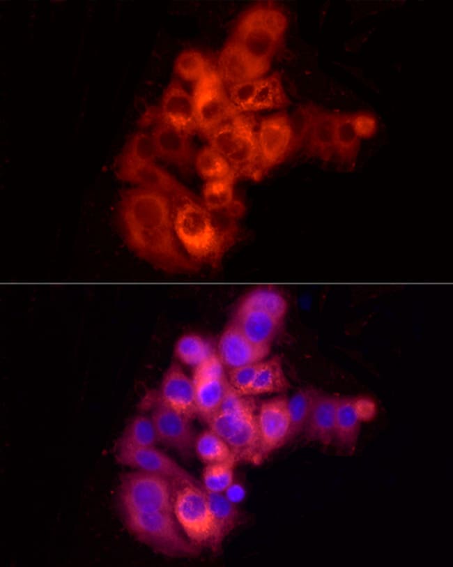 100UL HUMAN SERUM ALBUMIN ANTIBODY 100 u