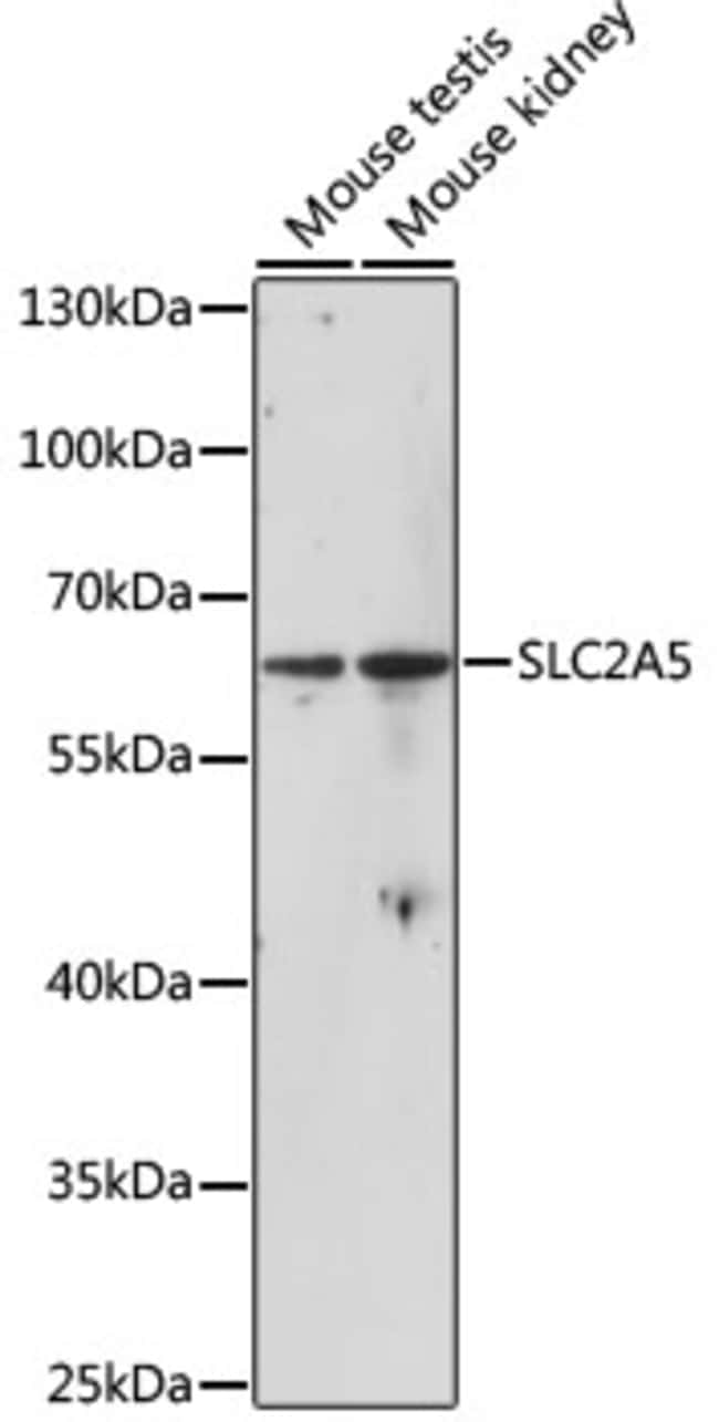 100UL GLUT5 ANTIBODY 100 ul