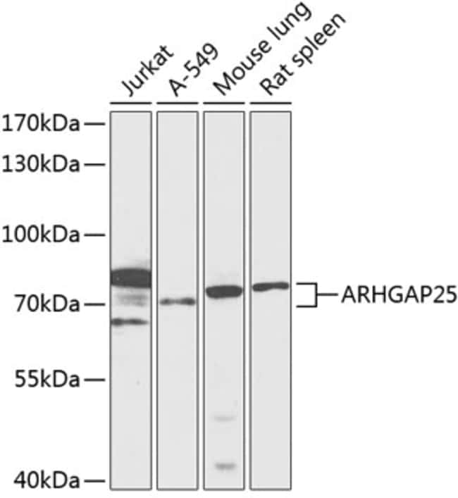 100UL ARHGAP25 ANTIBODY 100 ul