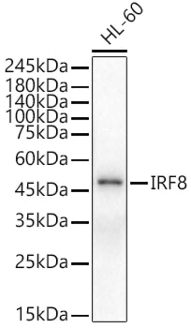 100UL IRF8 ANTIBODY 100 ul