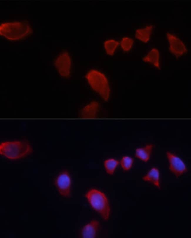 100UL CARBONIC ANHYDRASE IX ANTIBODY 100