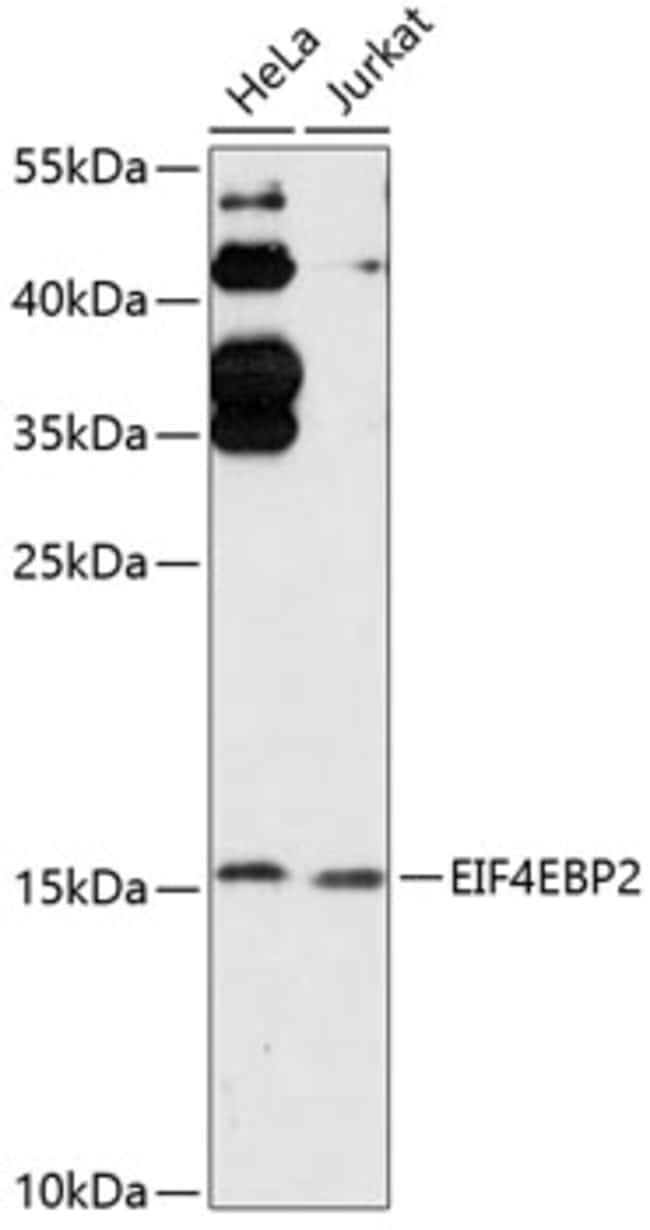 100UL 4E-BP2 ANTIBODY 100 ul