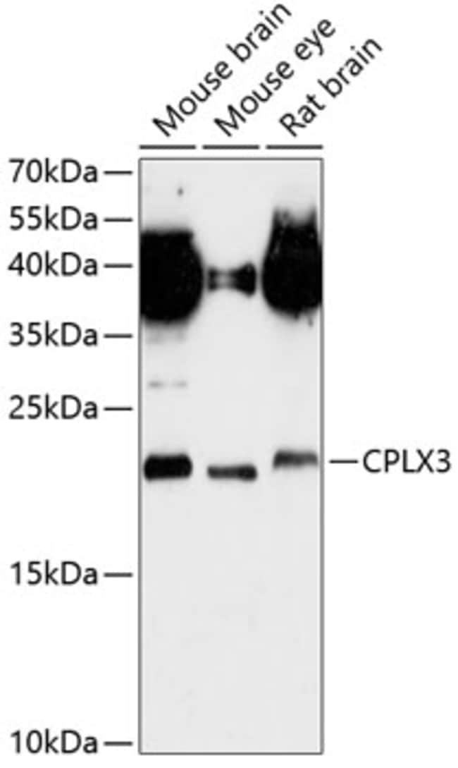 100UL CPLX3 ANTIBODY 100 ul