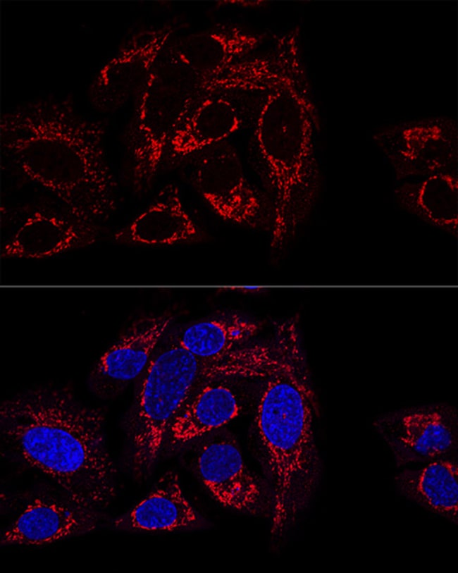 100UL GCSH ANTIBODY 100 ul