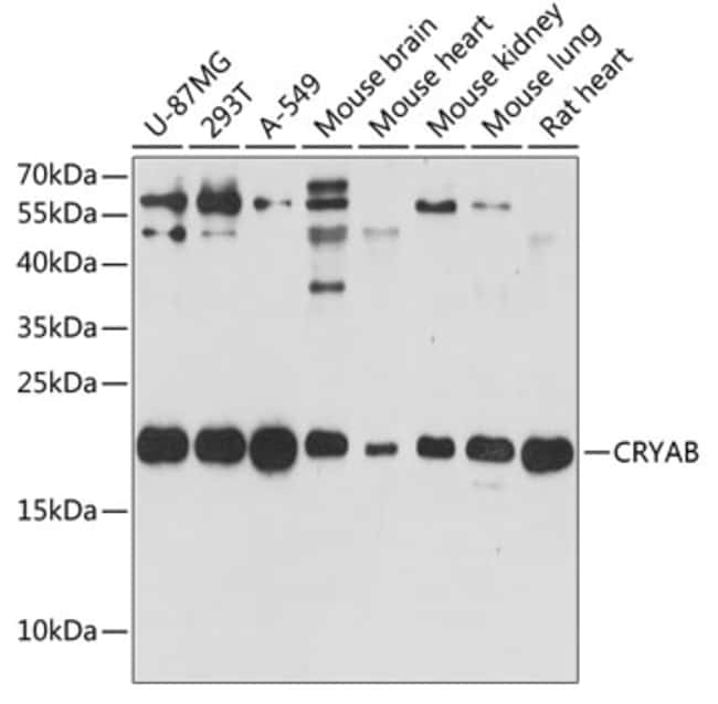 100UL CRYAB ANTIBODY 100 ul