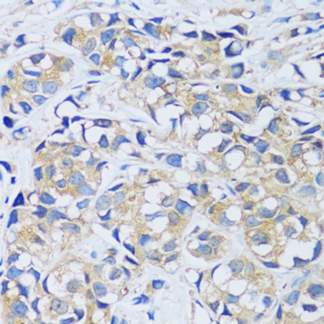 100UL CABP7 ANTIBODY 100 ul