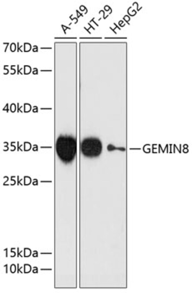 100UL GEMIN8 ANTIBODY 100 ul