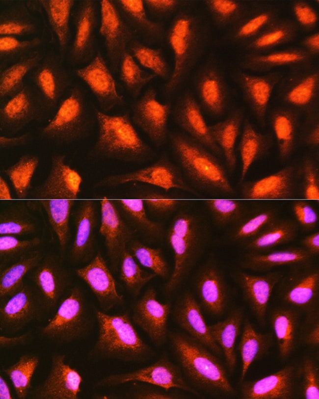 100UL MDFI ANTIBODY 100 ul