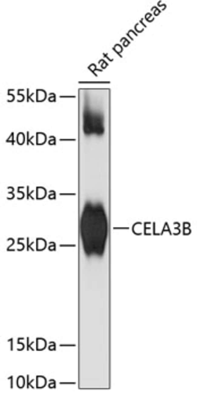 100UL CELA3B ANTIBODY 100 ul