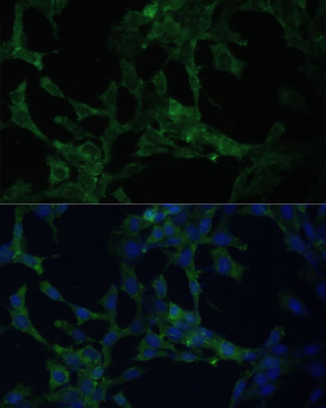 100UL CAMLG ANTIBODY 100 ul