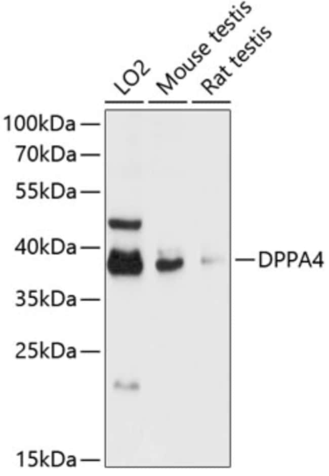 100UL DPPA4 ANTIBODY 100 ul