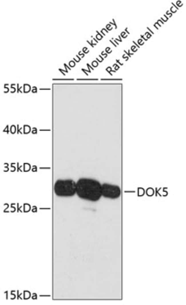 100UL DOK5 ANTIBODY 100 ul